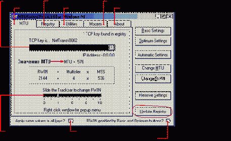 �������� MTU
