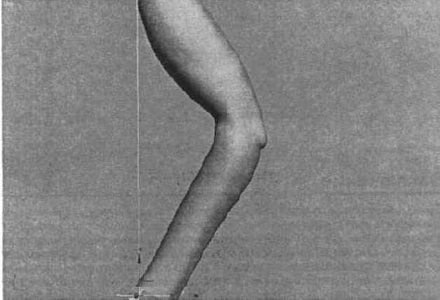 �������� ��������� ������� � �������������� Bones Pro