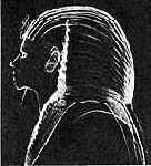 В РЕНТГЕНОВСКИХ ЛУЧАХ)