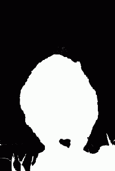 �������� ��������� Operation ��� �������� ���������