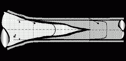 Возникновение турбулентного течения жидкости