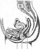 ������� ���� ���������� ����