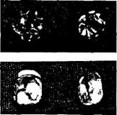 Колпакова - неизлечимых Болезней Нет