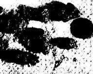 Колпакова - неизлечимых Болезней Нет