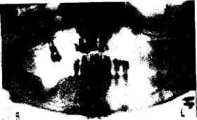 Колпакова - неизлечимых Болезней Нет