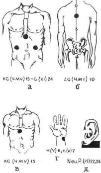 �������� - ������� ��������� �������