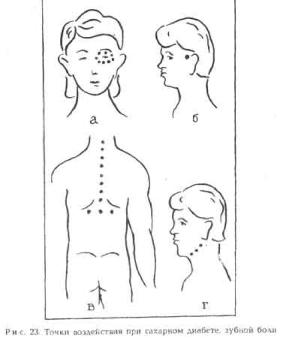 �������� - ������� ��������� �������