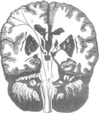 ��������� - � �������� � �� ��������