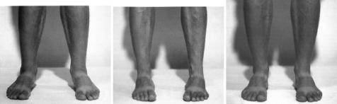 Болевые точки