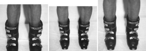 Болевые точки