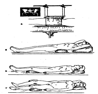 ���������� - �������� ���������� �������� (�������������)