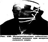 ���������� - �������� ���������� �������� (�������������)