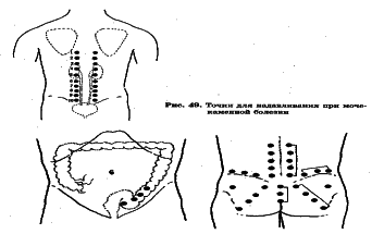 ���������� - �������� ���������� �������� (�������������)