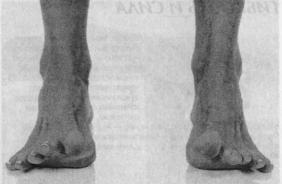 Вращение ступней