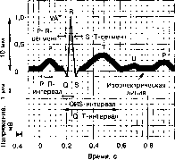 ����� - ����������� ����������� ���������������� �������
