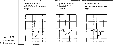 ����� - ����������� ����������� ���������������� �������
