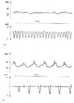 ��������, ������������� � ��������