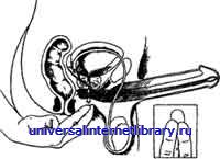 ������ - �������� ������� �����