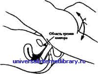 ������ - �������� ������� �����