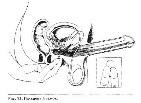 ����� ����������� ������. ������������ ����. �������� ���� �������